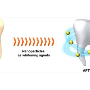 نانوذرات ، راه حل نسل بعدی برای سفید کردن دندان ها