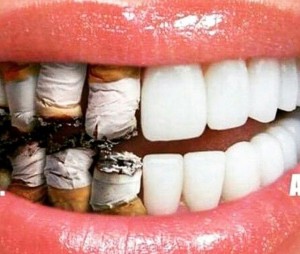 رابطه سیگار و بهداشت دهان و دندان